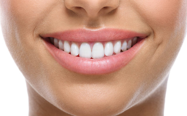 Closeup of a woman smiling with perfect teeth. Photo from Alpha Media Portland OR